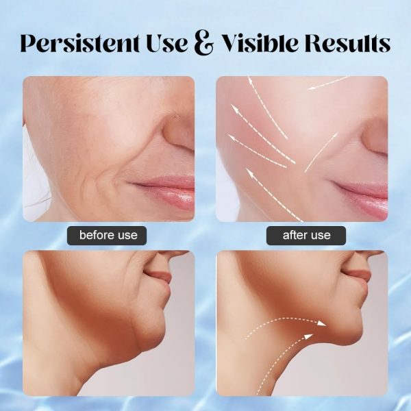 Massager For Face Lifting Linovyn