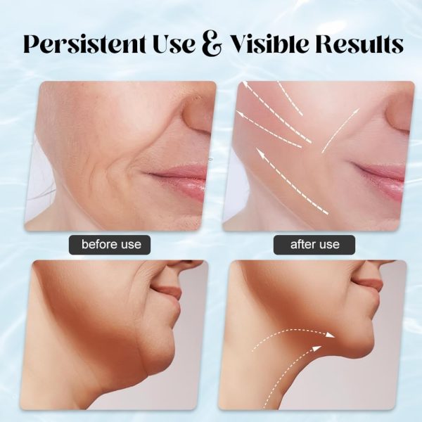 Massager For Face Lifting Linovyn