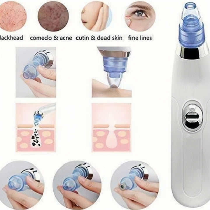 Derma Suction 4-in-1 Black Head Remover Machine Linovyn