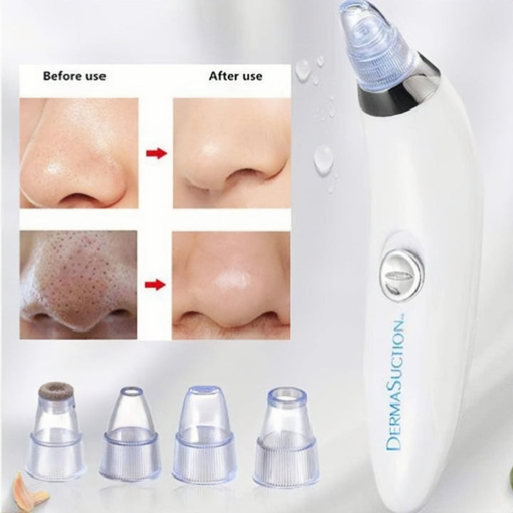 Derma Suction 4-in-1 Black Head Remover Machine Linovyn