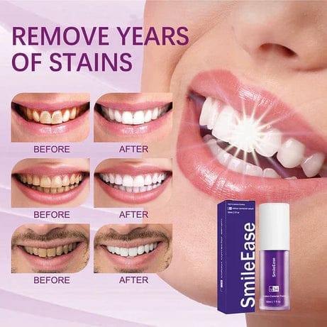 Hismile V34 Teeth Brightener Serum Linovyn