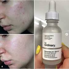 The Ordinary Niacinamide Serum Linovyn